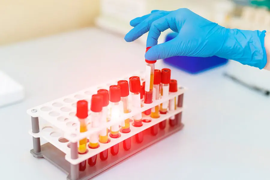 Doctors Hand Taking a Blood Sample