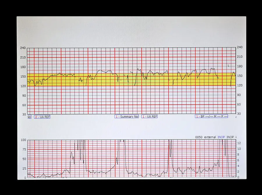 Fetal Heart and Uterus Data