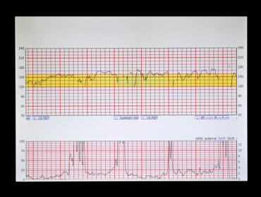 Fetal Heart and Uterus Data