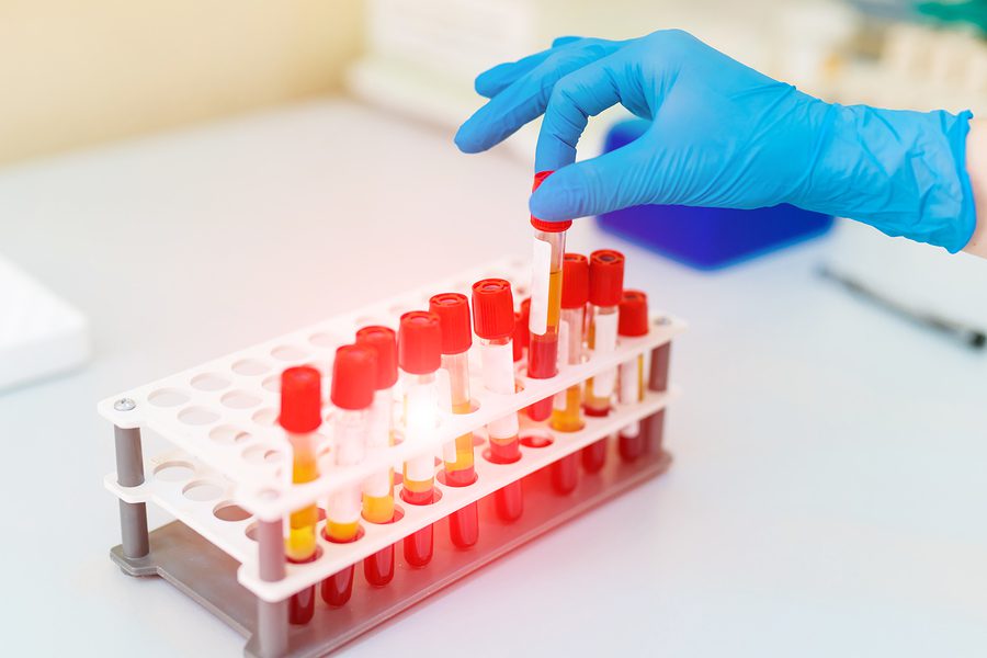 Doctors Hand Taking a Blood Sample
