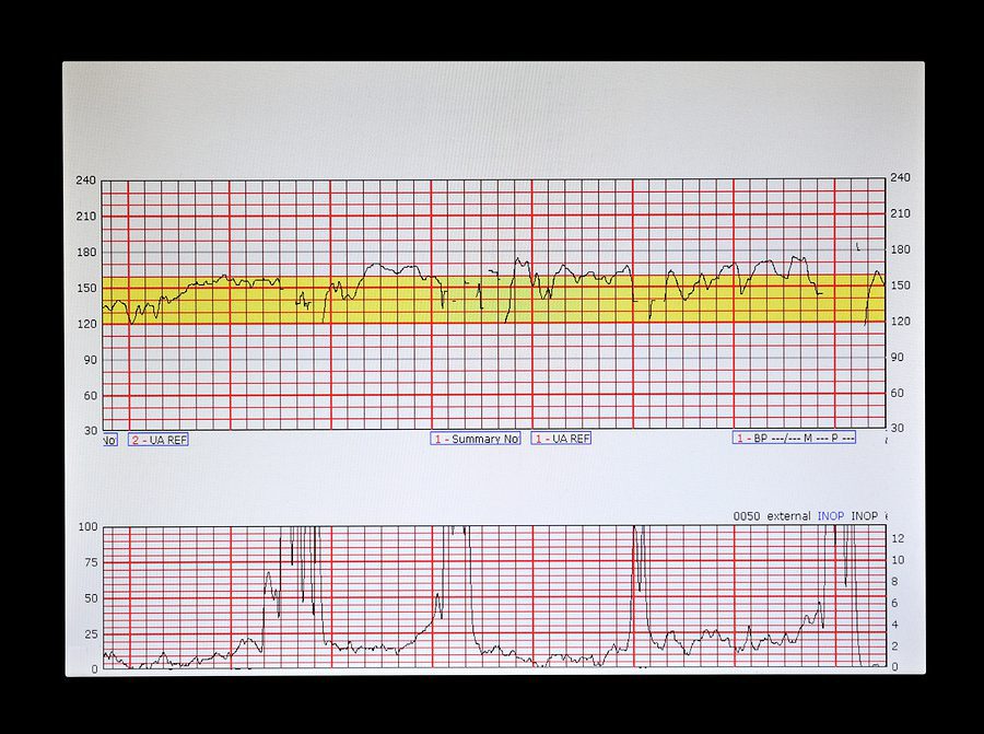 Fetal Heart and Uterus Data